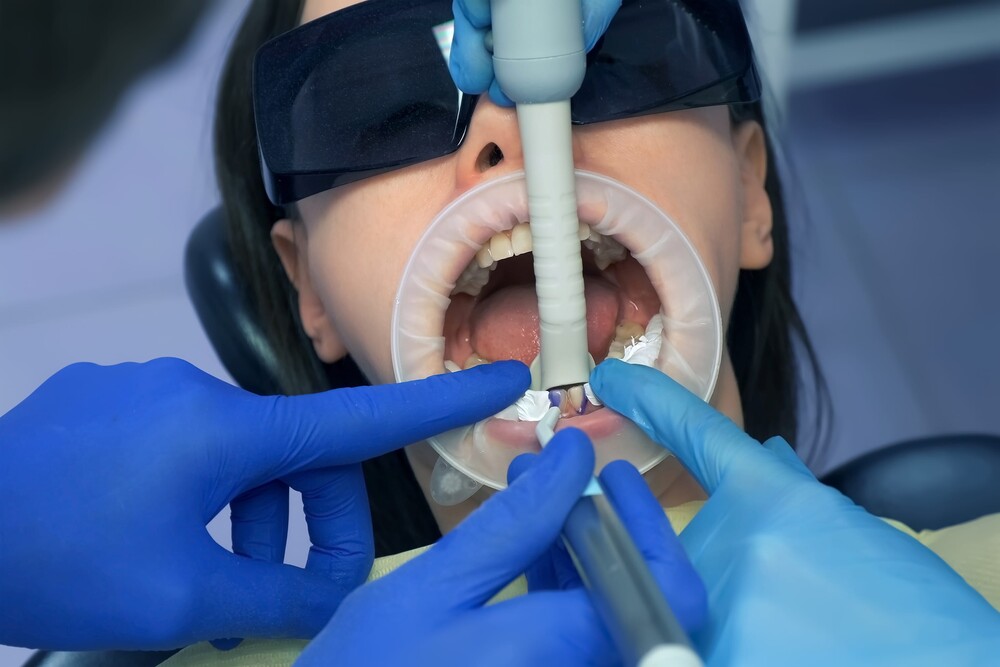 Revolutionizing Dental Care: The Advantages of Laser Dentistry